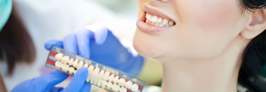 tooth-colored-fillings